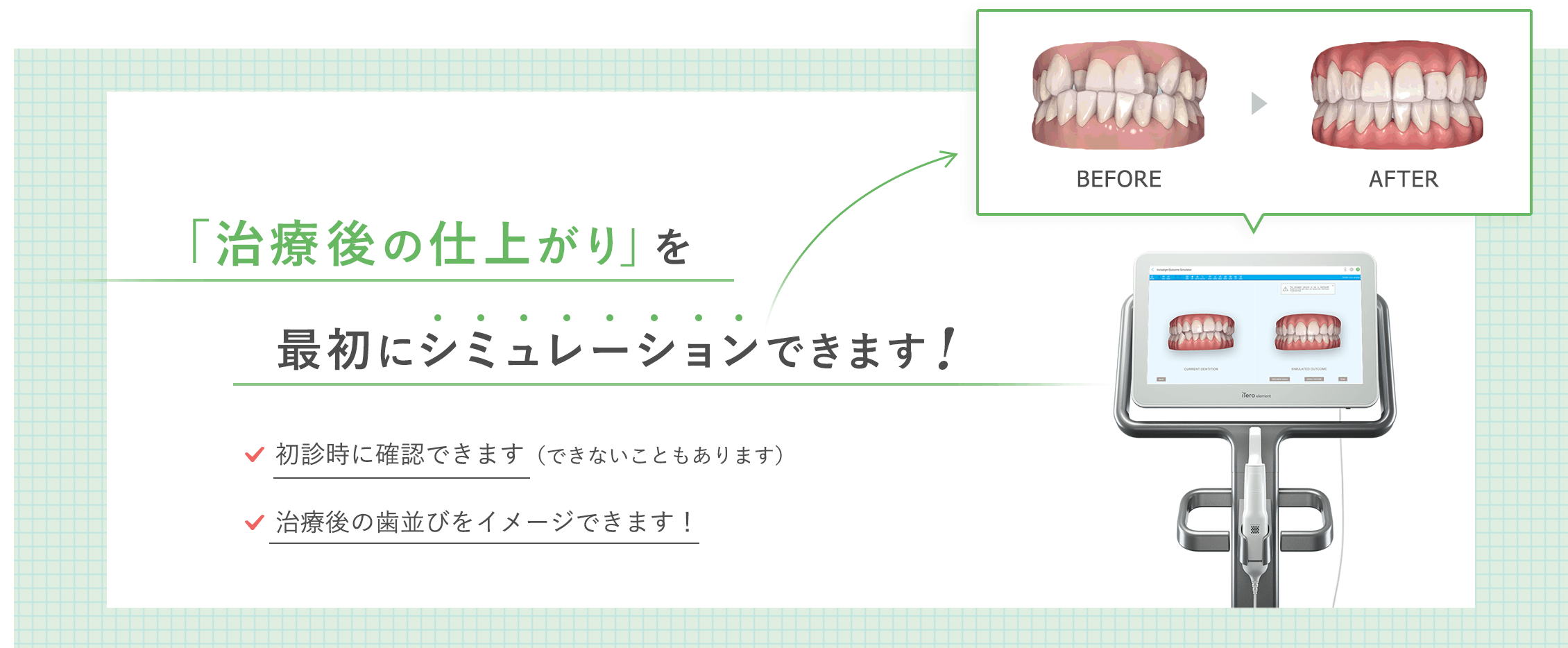 治療の仕上がりを事前にシミュレーションできます